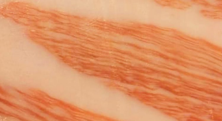 “Camarero: Hay un poco de jamón en mi grasa”. La esteatosis muscular